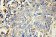 11317-1-AP - Beta-hexosaminidase alpha / HEXA