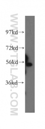 11317-1-AP - Beta-hexosaminidase alpha / HEXA