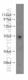 11317-1-AP - Beta-hexosaminidase alpha / HEXA