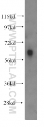 11317-1-AP - Beta-hexosaminidase alpha / HEXA