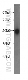 11317-1-AP - Beta-hexosaminidase alpha / HEXA