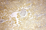 16229-1-AP - Beta-hexosaminidase beta / HEXB