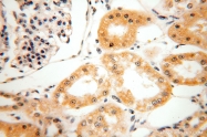 16229-1-AP - Beta-hexosaminidase beta / HEXB