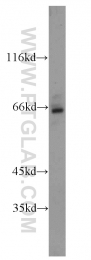 16229-1-AP - Beta-hexosaminidase beta / HEXB