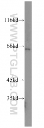16229-1-AP - Beta-hexosaminidase beta / HEXB