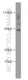 16229-1-AP - Beta-hexosaminidase beta / HEXB