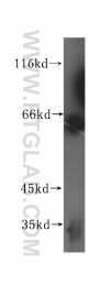 16229-1-AP - Beta-hexosaminidase beta / HEXB