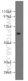 16229-1-AP - Beta-hexosaminidase beta / HEXB