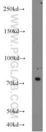 11654-1-AP - Hedgehog-interacting protein / HHIP