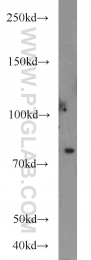 11654-1-AP - Hedgehog-interacting protein / HHIP