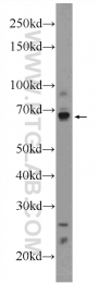 24949-1-AP - HIC1 / ZBTB29