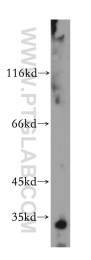 15446-1-AP - Histone H1.2