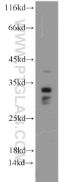 15446-1-AP - Histone H1.2