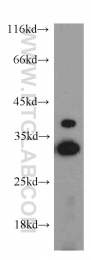 15446-1-AP - Histone H1.2