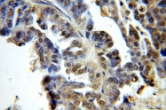 19649-1-AP - Histone H1.2