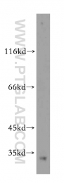 19649-1-AP - Histone H1.2