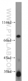 19649-1-AP - Histone H1.2