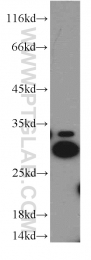 19649-1-AP - Histone H1.2