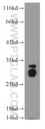 19649-1-AP - Histone H1.2