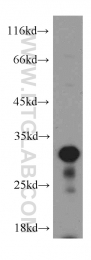 19649-1-AP - Histone H1.2