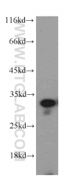 19649-1-AP - Histone H1.2