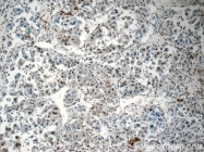 15302-1-AP - Histone H2A type 2-A