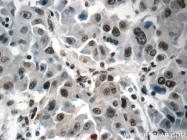 15302-1-AP - Histone H2A type 2-A