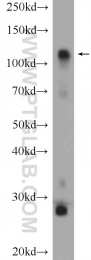 15656-1-AP - Hexokinase-1