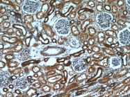 19662-1-AP - Hexokinase-1
