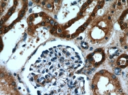 19662-1-AP - Hexokinase-1