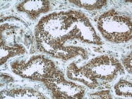 19662-1-AP - Hexokinase-1