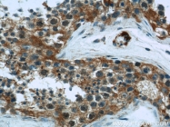 19662-1-AP - Hexokinase-1