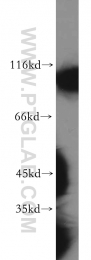 19662-1-AP - Hexokinase-1