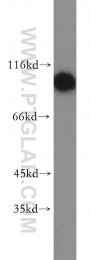 19662-1-AP - Hexokinase-1