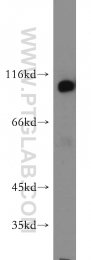 19662-1-AP - Hexokinase-1