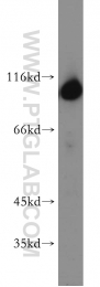 19662-1-AP - Hexokinase-1