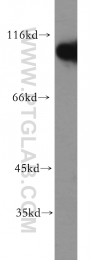 19662-1-AP - Hexokinase-1