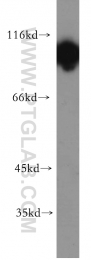 19662-1-AP - Hexokinase-1