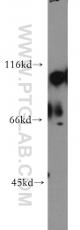19662-1-AP - Hexokinase-1