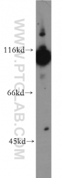 19662-1-AP - Hexokinase-1