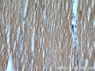 22029-1-AP - Hexokinase-2
