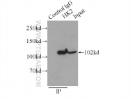 22029-1-AP - Hexokinase-2