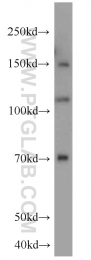 22029-1-AP - Hexokinase-2