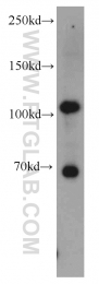 22029-1-AP - Hexokinase-2