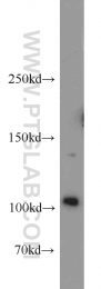 22029-1-AP - Hexokinase-2