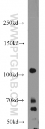 22029-1-AP - Hexokinase-2