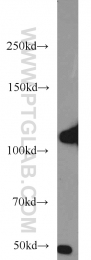 22029-1-AP - Hexokinase-2