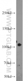 22029-1-AP - Hexokinase-2