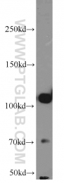 22029-1-AP - Hexokinase-2