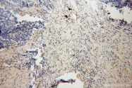 13333-1-AP - Hexokinase-3